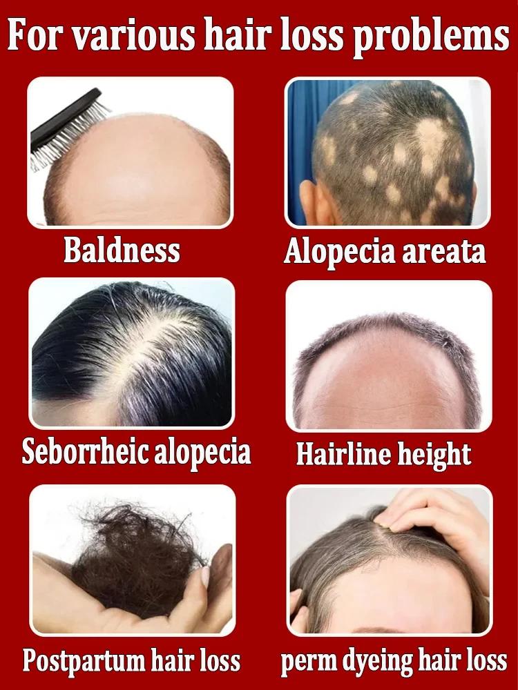 https://ae-pic-a1.aliexpress-media.com/kf/S0e5f24fb62324811ab04bbfbc16375f23.jpg