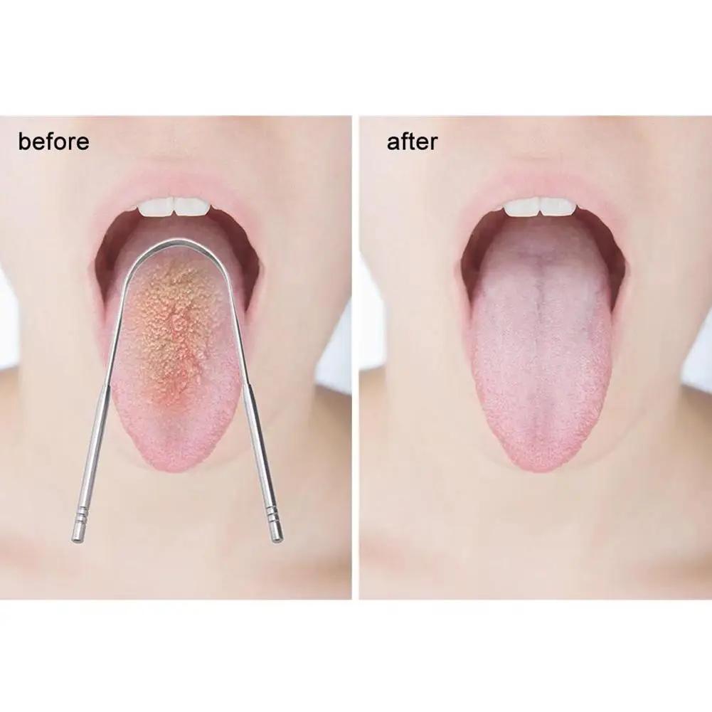 https://ae-pic-a1.aliexpress-media.com/kf/S9284a92690824245ab442d5305a7b45cw.jpg